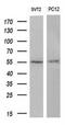RAC-gamma serine/threonine-protein kinase antibody, NBP1-47657, Novus Biologicals, Western Blot image 
