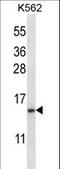 TNF Receptor Superfamily Member 13C antibody, LS-C162062, Lifespan Biosciences, Western Blot image 