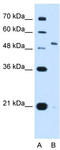 Potassium Voltage-Gated Channel Subfamily C Member 1 antibody, TA339437, Origene, Western Blot image 