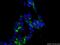 Cystinosin, Lysosomal Cystine Transporter antibody, 13085-1-AP, Proteintech Group, Immunofluorescence image 