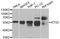 Autophagy Related 5 antibody, A0203, ABclonal Technology, Western Blot image 