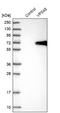 Vacuolar Protein Sorting 45 Homolog antibody, NBP1-81641, Novus Biologicals, Western Blot image 