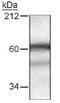 Histone Deacetylase 10 antibody, PA1-46293, Invitrogen Antibodies, Western Blot image 