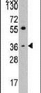 Thrombopoietin antibody, PA5-14493, Invitrogen Antibodies, Western Blot image 