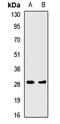 Major Histocompatibility Complex, Class II, DR Alpha antibody, LS-C667843, Lifespan Biosciences, Western Blot image 