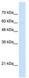 Leucine Zipper And EF-Hand Containing Transmembrane Protein 1 antibody, TA341905, Origene, Western Blot image 