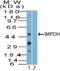 Inosine Monophosphate Dehydrogenase 2 antibody, NBP2-27195, Novus Biologicals, Western Blot image 