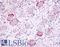Transient Receptor Potential Cation Channel Subfamily A Member 1 antibody, LS-A9097, Lifespan Biosciences, Immunohistochemistry paraffin image 