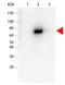 AKT Serine/Threonine Kinase 2 antibody, orb345010, Biorbyt, Western Blot image 