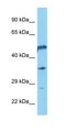 Rho Guanine Nucleotide Exchange Factor 3 antibody, orb326189, Biorbyt, Western Blot image 