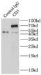 CD5 Molecule antibody, FNab01487, FineTest, Immunoprecipitation image 