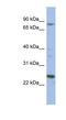 Microtubule Affinity Regulating Kinase 3 antibody, NBP1-56956, Novus Biologicals, Western Blot image 