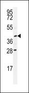 Ubiquitin Specific Peptidase 50 antibody, LS-C160479, Lifespan Biosciences, Western Blot image 