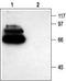 Synaptotagmin 1 antibody, TA328891, Origene, Western Blot image 