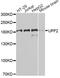 UPF2 Regulator Of Nonsense Mediated MRNA Decay antibody, A7091, ABclonal Technology, Western Blot image 