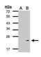 Glutathione Peroxidase 7 antibody, GTX105683, GeneTex, Western Blot image 