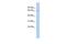 La Ribonucleoprotein Domain Family Member 4 antibody, GTX47233, GeneTex, Western Blot image 