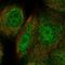 RAD51 Paralog C antibody, HPA045198, Atlas Antibodies, Immunofluorescence image 