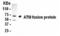 ATM Serine/Threonine Kinase antibody, XW-7045, ProSci, Western Blot image 