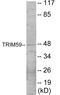 Tripartite Motif Containing 59 antibody, EKC1867, Boster Biological Technology, Western Blot image 