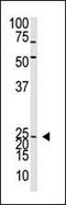 Neurogenin 2 antibody, PA5-11892, Invitrogen Antibodies, Western Blot image 