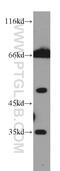 Carbohydrate Sulfotransferase 12 antibody, 15341-1-AP, Proteintech Group, Western Blot image 