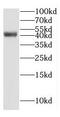 GTF2H2 Family Member C, Copy 2 antibody, FNab03713, FineTest, Western Blot image 