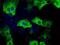 Transforming Acidic Coiled-Coil Containing Protein 3 antibody, MA5-25128, Invitrogen Antibodies, Immunocytochemistry image 