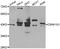 Casein Kinase 1 Gamma 1 antibody, abx006491, Abbexa, Western Blot image 