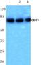 Ectonucleoside Triphosphate Diphosphohydrolase 1 antibody, GTX17496, GeneTex, Western Blot image 