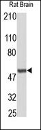 Abl Interactor 1 antibody, 251822, Abbiotec, Immunohistochemistry paraffin image 