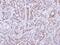 PTPN11 antibody, PA5-27312, Invitrogen Antibodies, Immunohistochemistry paraffin image 