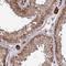 Copper Chaperone For Superoxide Dismutase antibody, HPA044090, Atlas Antibodies, Immunohistochemistry paraffin image 
