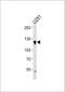 Endothelin-converting enzyme 2 antibody, PA5-35266, Invitrogen Antibodies, Western Blot image 