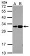 Rab Interacting Lysosomal Protein Like 2 antibody, NBP2-20162, Novus Biologicals, Western Blot image 
