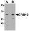 Growth Factor Receptor Bound Protein 10 antibody, LS-C153751, Lifespan Biosciences, Western Blot image 