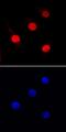 Spi-1 Proto-Oncogene antibody, MAB7124, R&D Systems, Immunocytochemistry image 