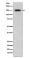 Desmoglein 1 antibody, M02655-1, Boster Biological Technology, Western Blot image 