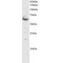 SMAD Family Member 4 antibody, PA1-31458, Invitrogen Antibodies, Western Blot image 