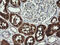 Gamma-Butyrobetaine Hydroxylase 1 antibody, M09779, Boster Biological Technology, Immunohistochemistry paraffin image 
