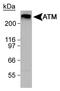 ATM Serine/Threonine Kinase antibody, NB100-104, Novus Biologicals, Western Blot image 