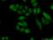 MAPK Activated Protein Kinase 2 antibody, 13949-1-AP, Proteintech Group, Immunofluorescence image 