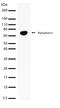 Metadherin antibody, 701171, Invitrogen Antibodies, Western Blot image 