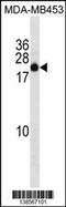 Zinc Finger Protein 747 antibody, 59-999, ProSci, Western Blot image 