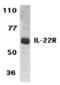 Interleukin 22 Receptor Subunit Alpha 1 antibody, MBS150302, MyBioSource, Western Blot image 