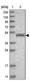 Adenylate Kinase 8 antibody, NBP1-88242, Novus Biologicals, Western Blot image 