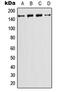 Phosphatidylinositol-4-Phosphate 3-Kinase Catalytic Subunit Type 2 Gamma antibody, MBS820611, MyBioSource, Western Blot image 