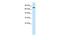 Nuclear Receptor Binding SET Domain Protein 2 antibody, PA5-40725, Invitrogen Antibodies, Western Blot image 