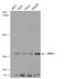 UPF1 RNA Helicase And ATPase antibody, GTX112241, GeneTex, Western Blot image 