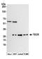 Trans-2,3-Enoyl-CoA Reductase antibody, A305-515A, Bethyl Labs, Western Blot image 
